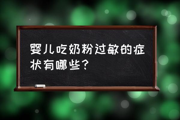 怎么知道宝宝是不是奶粉过敏 婴儿吃奶粉过敏的症状有哪些？